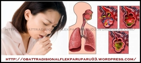 obat tradisional flek paru paru